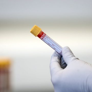 Abu Dhabi to Launch First Centre for Early Detection of Alzheimer’s